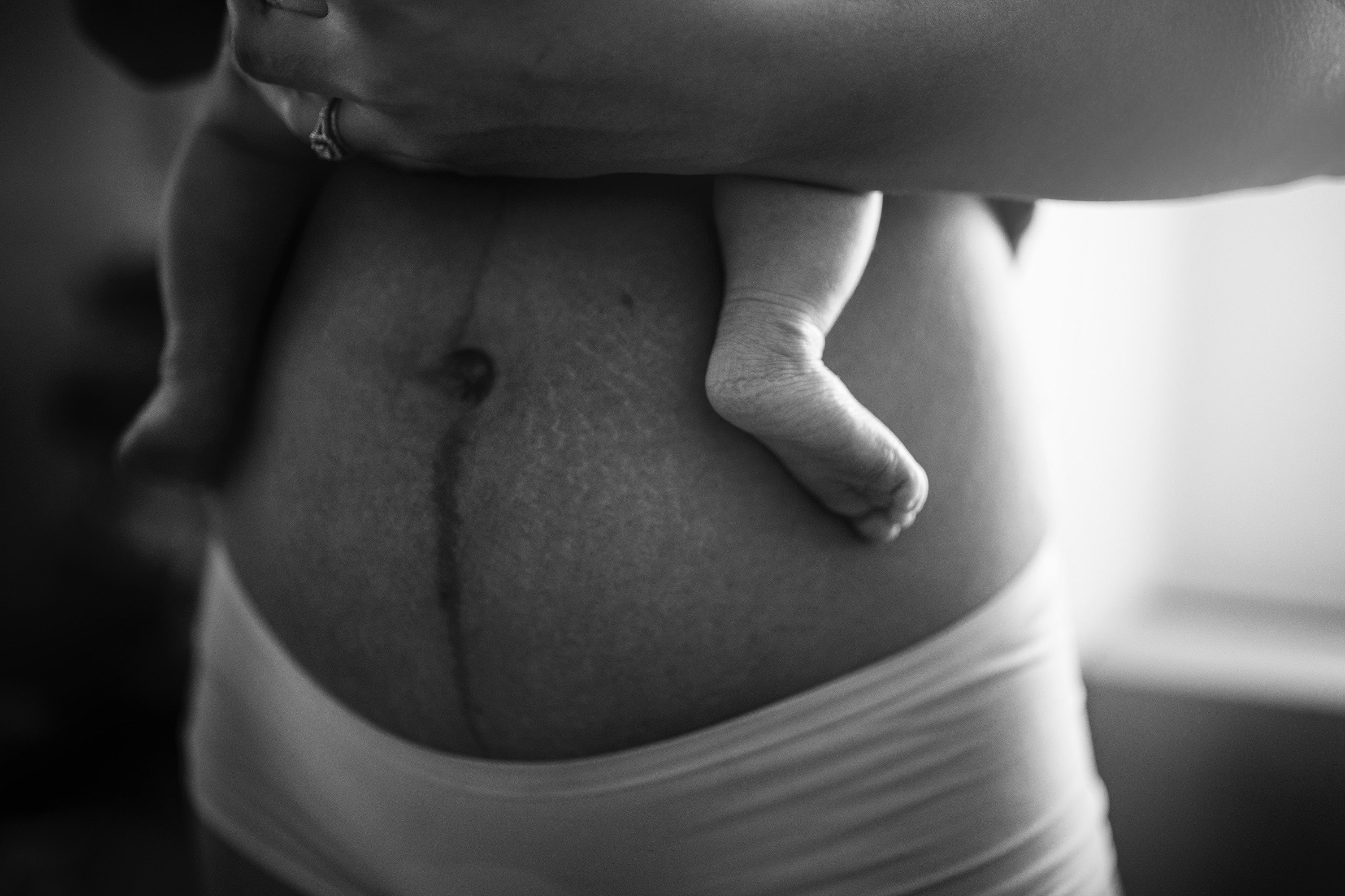 How to assess yourself for Diastasis recti