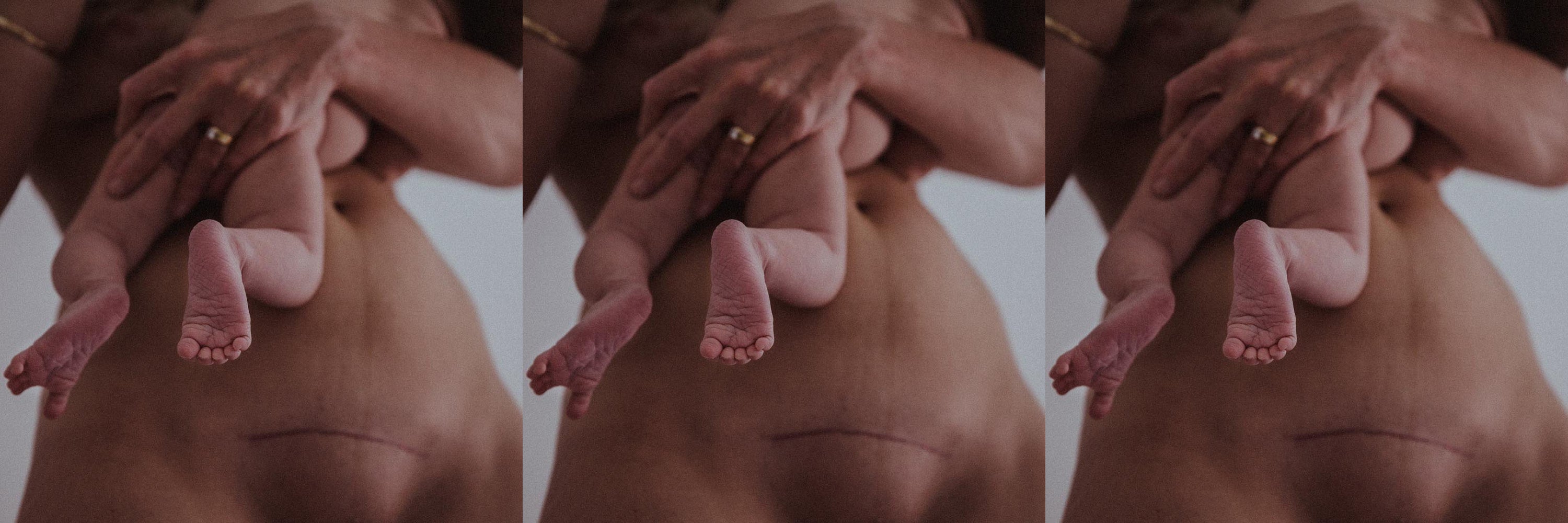 Womans C-Section Scar, holding her baby, c-section recovery trousers